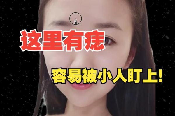 痣相揭秘：小指有痣的人，命运如何？